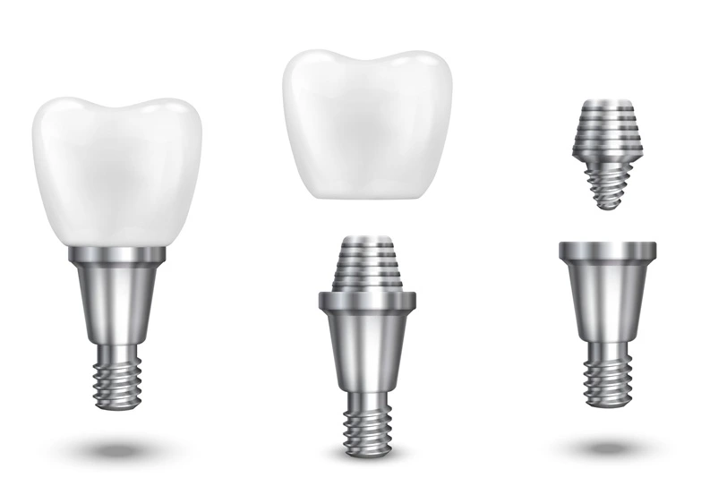 Dental implants hero new