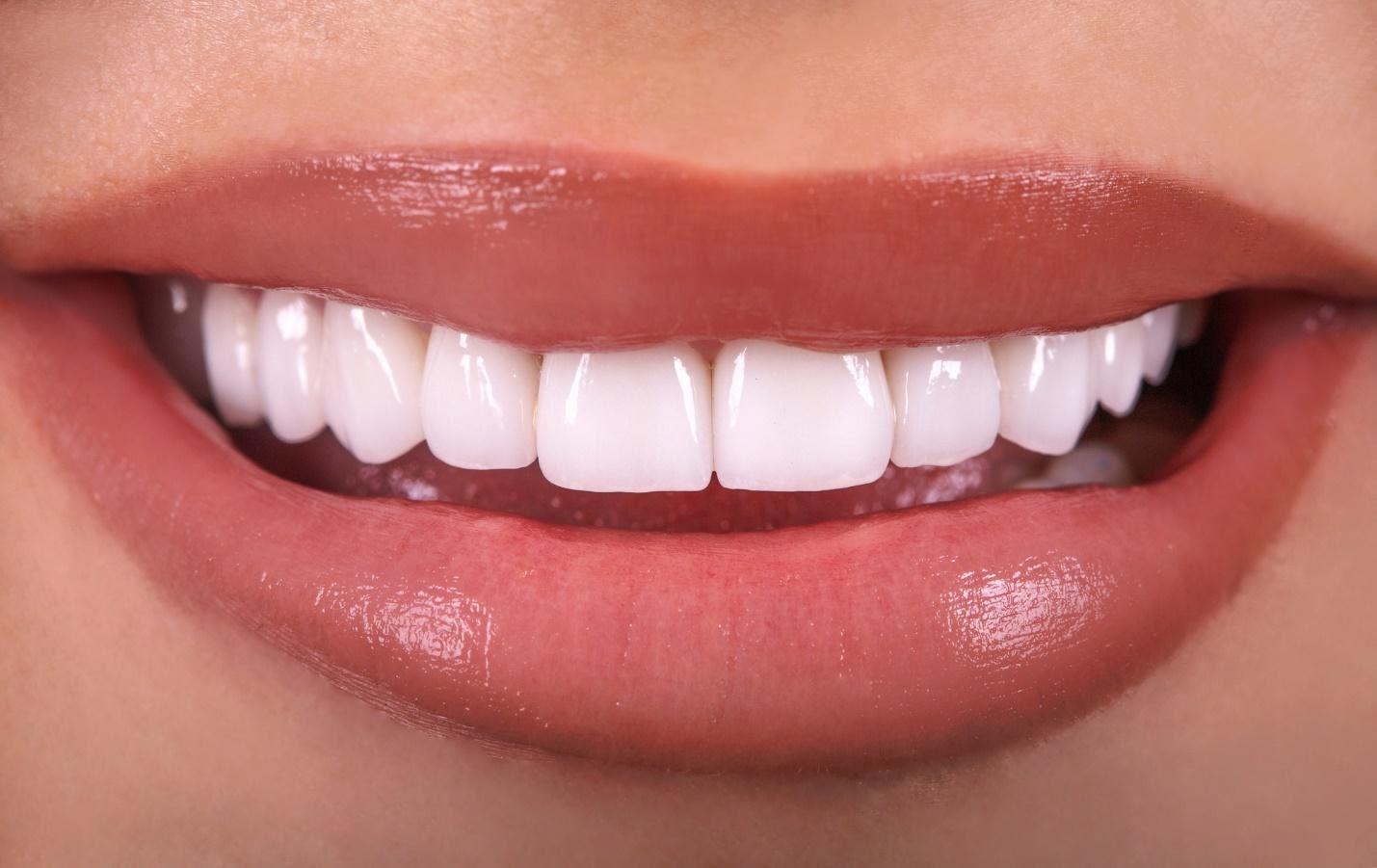 Cosmetic dentistry smile result